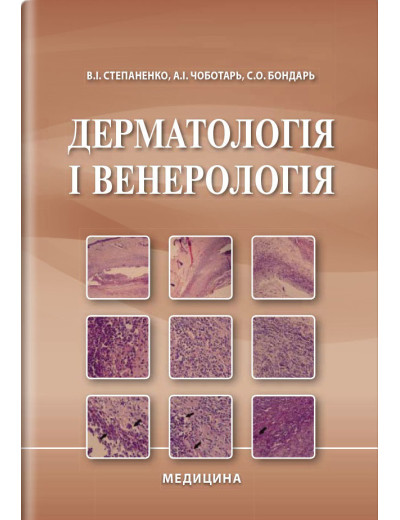 Дерматологія і венерологія: підручник / В. І. Степаненко, А. І. Чоботарь, С. О. Бондар та ін. — 2-е видання