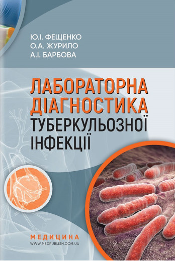 Лабораторна діагностика туберкульозної інфекції: Навч. посіб. для фахівців бактеріологіч лабораторій.
