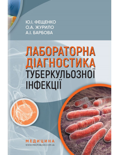 Лабораторна діагностика туберкульозної інфекції: Навч. посіб. для фахівців бактеріологіч лабораторій.