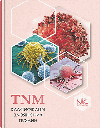 TNM класифікація злоякісних пухлин. Шевченко А.І.(за ред.)