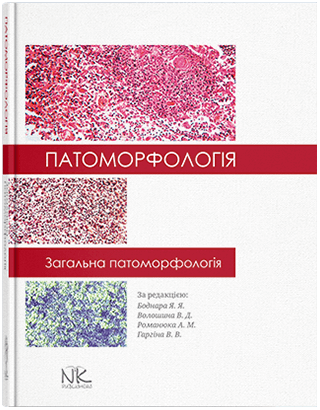 Патоморфологія. Загальна патоморфологія. Боднар Я. Я. та ін.