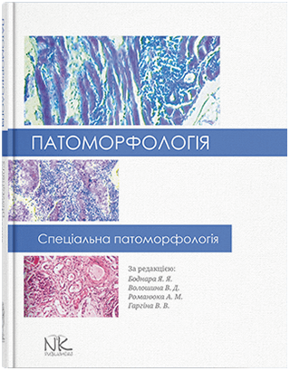 Патоморфологія. Спеціальна патоморфологія. Боднар Я. Я., Волошина В. Д., Романюк А. М., Гаргіна В. В.