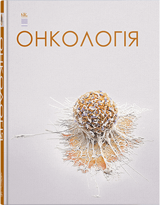 Онкологія. Шевченко А. І. та ін.
