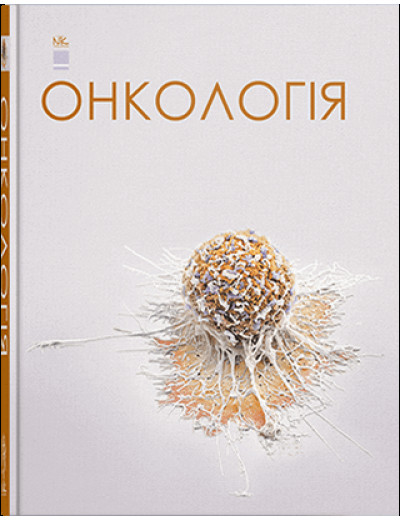 Онкологія. Шевченко А. І. та ін.