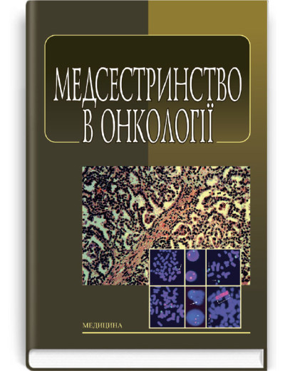 Медсестринство в онкології: підручник (ВНЗ І—ІІІ р. а.). Л.М. Ковальчук, О.М. Парійчук, І.І. Романишин та ін.